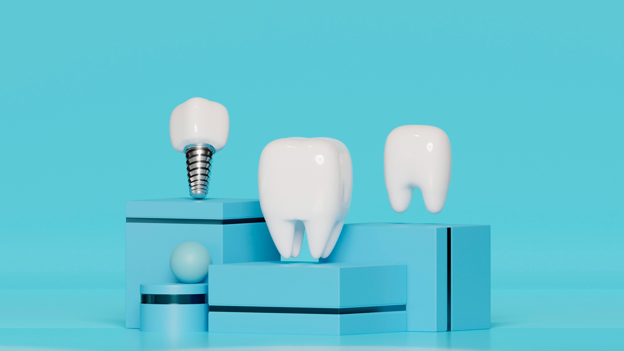 Dental Implants