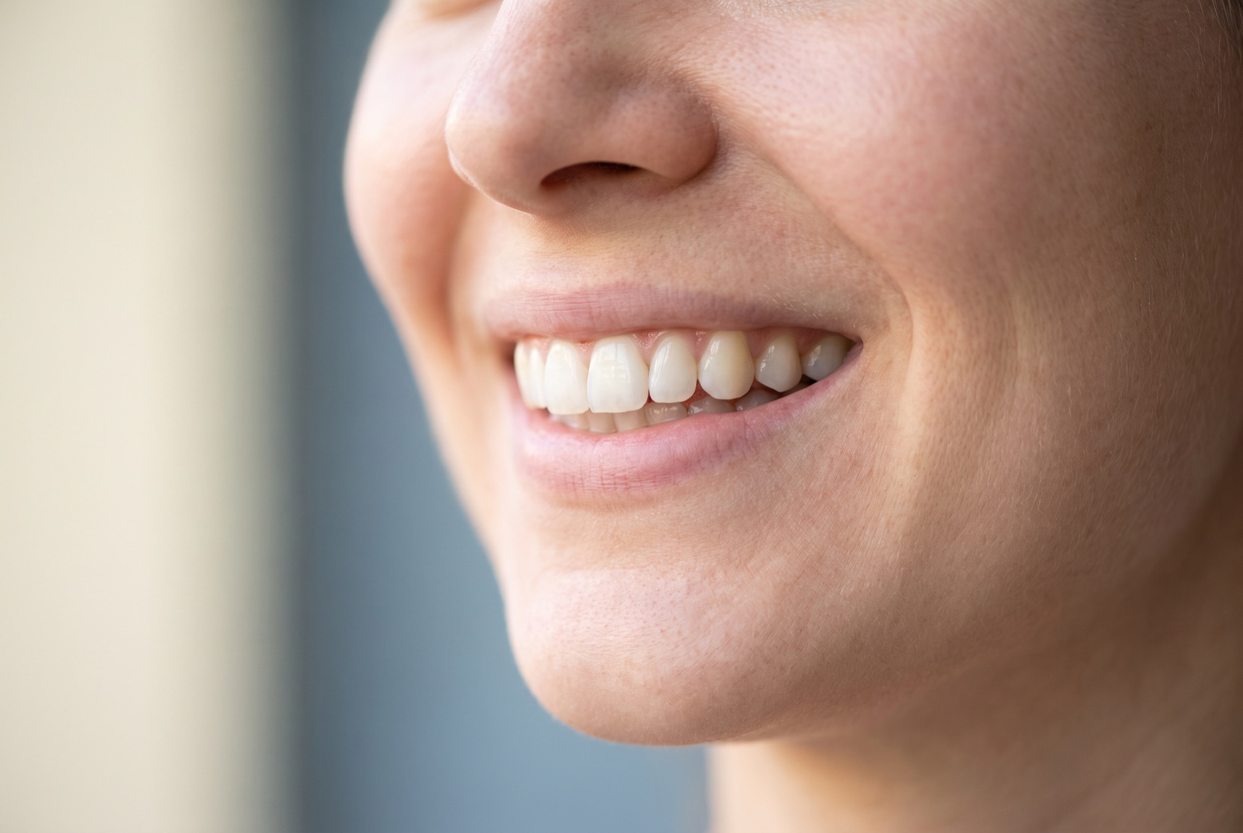 A refined, natural-looking smile