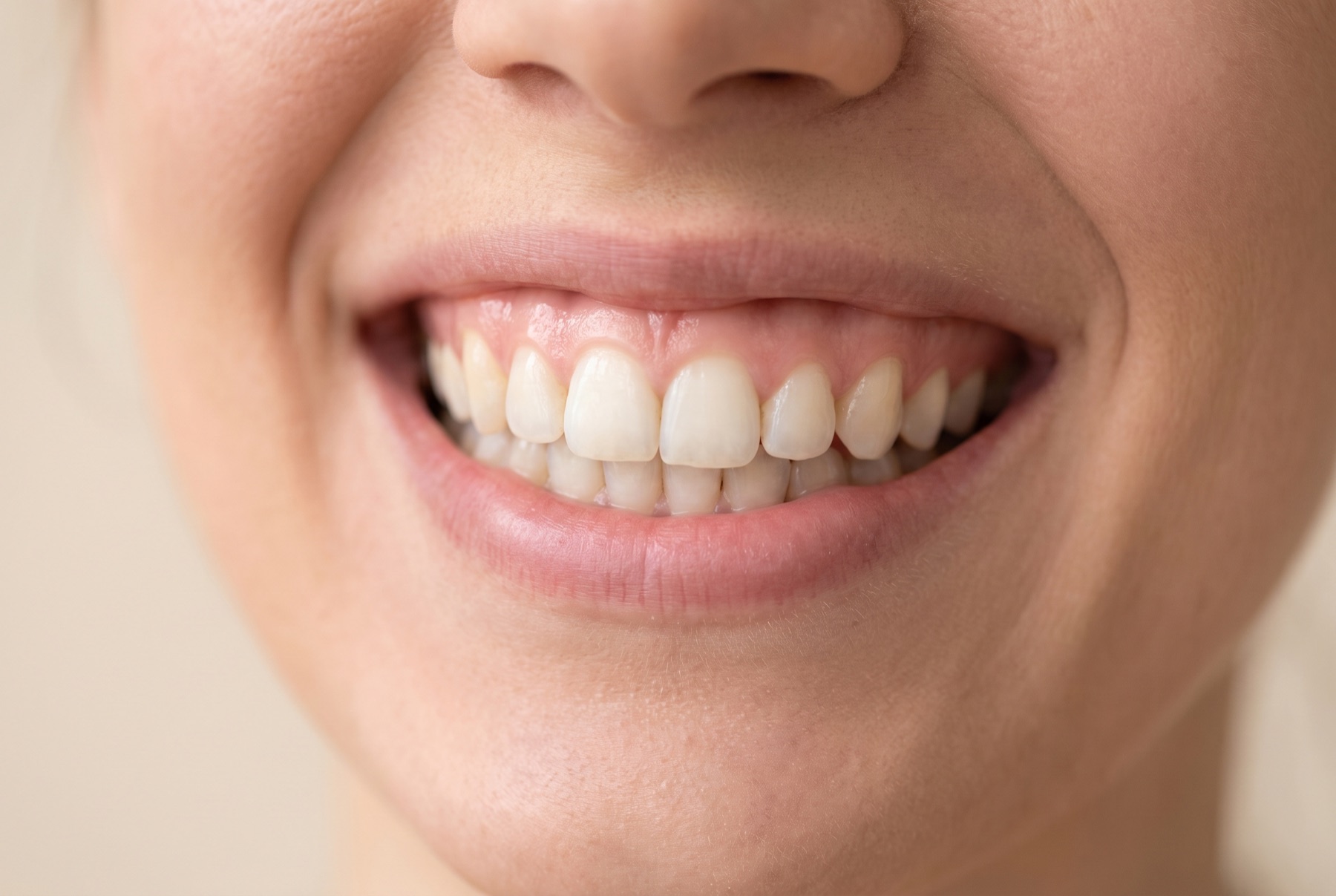 A smile with a balanced, even gum line