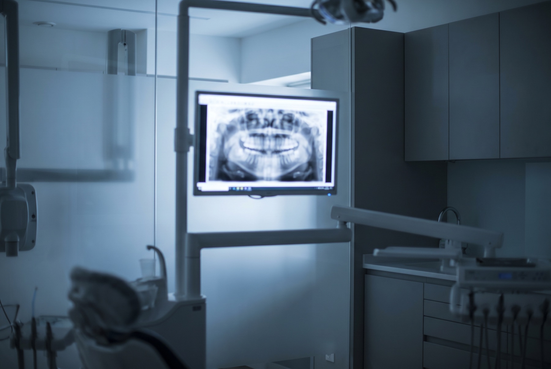 A dental panoramic X-ray on a clinical screen