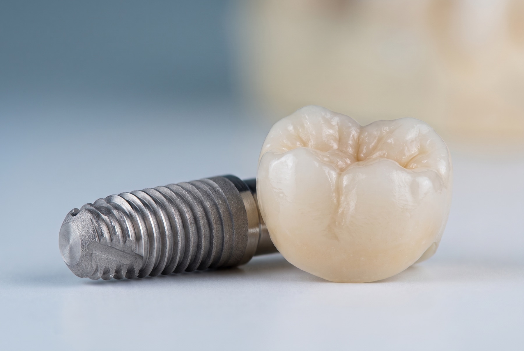 Dental implant and porcelain crown