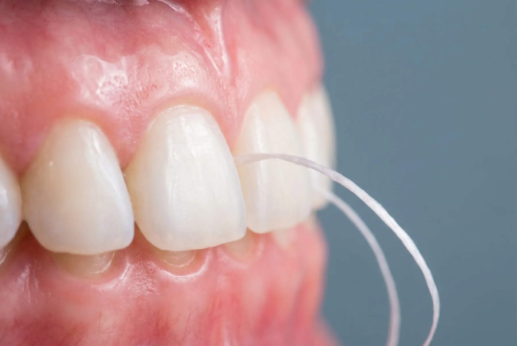 Healthy gums and dental hygiene