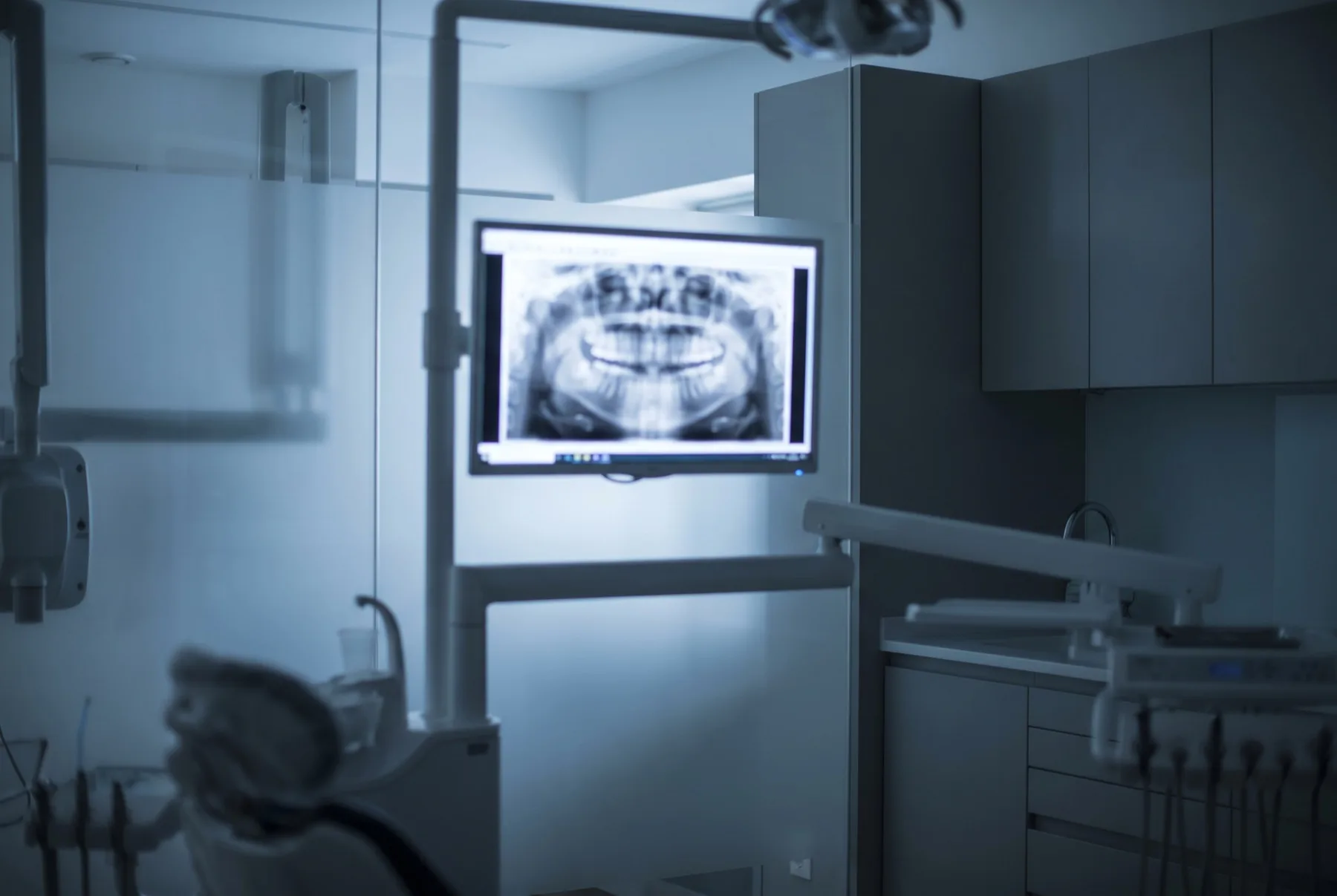 A dental panoramic X-ray on a clinical screen
